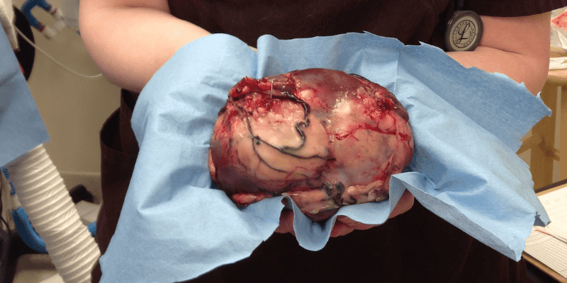 tumor, pet tumor removal, pet surgeries, AERC Surgery Service, most common pet surgeries, board-certified veterinary surgeon, Animal Emergency & Referral Center of Minnesota, pet surgeon, Twin Cities pet surgeon, Minnesota pet surgeon, pet health, veterinary surgery