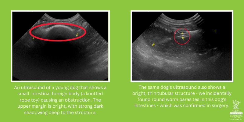 Two images of abdominal ultrasound findings. The left ultrasound shows an ultrasound of a young dog that shows a small intestinal foreign body (a knotted rope toy) causing an obstruction. The upper margin is bright, with strong dark shadowing deep to the structure. The right ultrasound is the same dog's ultrasound also shows a bright, thin tubular structure - we incidentally found round worm parasites in this dog's intestines - which was confirmed in surgery. Both ultrasounds from Animal Emergency & Referral Center of Minnesota.